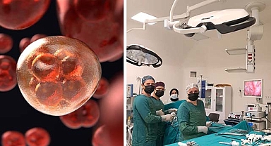 Kolon kanserinin erken tespiti için uzmanından uyarı!