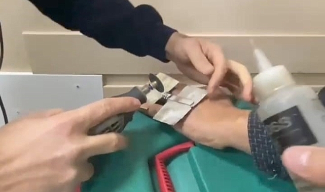 Şanlıurfa'da parmağına yüzük sıkışan vatandaşın imdadına ekipler yetişti!