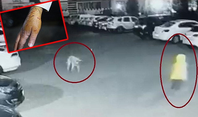 Diyarbakır'da sokak köpeğinin saldırdığı 3 kişi yaralandı