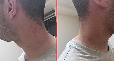 Şanlıurfa'da yaşanan olayda Gazeteciye saldıran iki şüpheliye hapis istemi