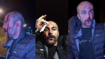 Şanlıurfa'da müvekkilinin yanına giden avukata darp iddiası