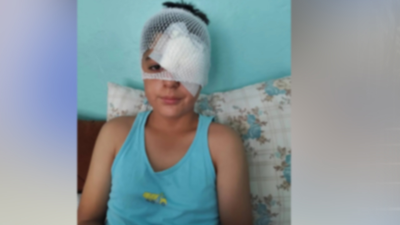 Şanlıurfa'da köpek saldırısından kaçan çocuğa otomobil çarptı