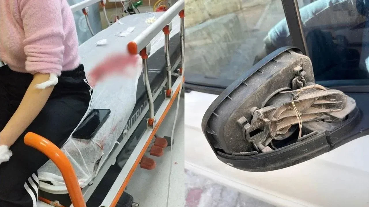 Şanlıurfa’da görümce eski yengeye dehşeti yaşattı!