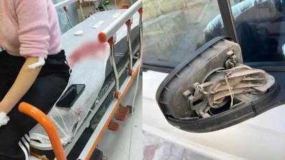 Şanlıurfa’da görümce eski yengeye dehşeti yaşattı!